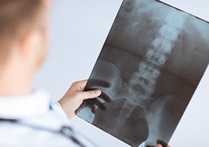 Chiropractic Traverse City MI Our Process - X Ray Chiropractic Traverse City MI Our Process - X Ray