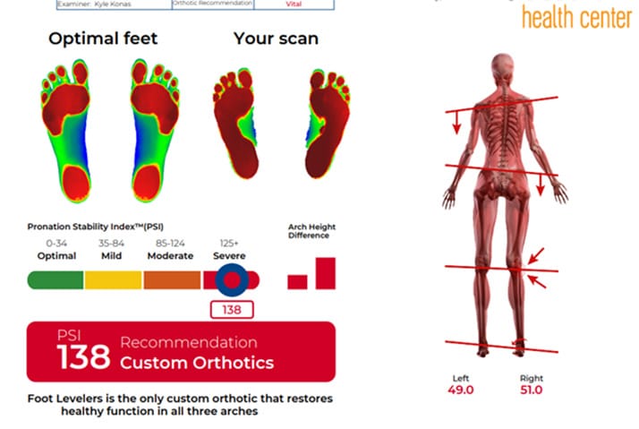 Chiropractic Traverse City MI Foot Scan