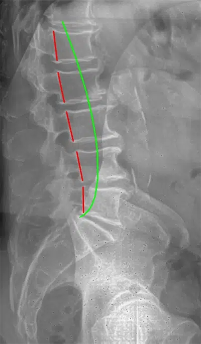 Chiropractor Traverse City MI X Ray